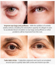 Load image into Gallery viewer, Magic Eye Cream-28 seconds to remove eye bags / dark circles / eye wrinkles
