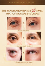 Load image into Gallery viewer, Magic Eye Cream-28 seconds to remove eye bags / dark circles / eye wrinkles

